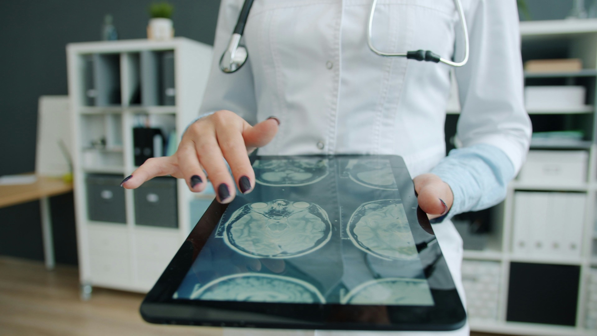 The Medical AI Revolution: How Today's Diagnostic Tools Are Shaping Tomorrow's Treatment Protocols