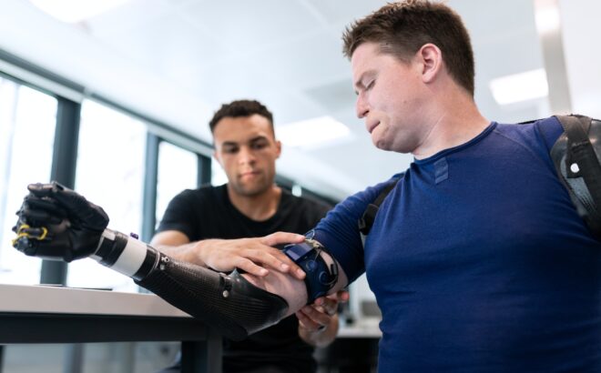 A man wearing a bionic arm developed with biotechnology